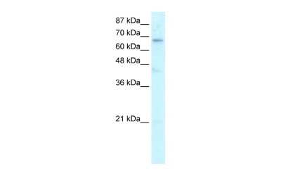 Western Blot: Hairless Antibody [NBP2-87554]