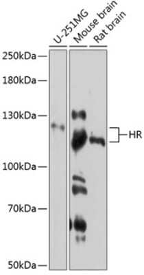 Western Blot: Hairless AntibodyAzide and BSA Free [NBP3-03555]