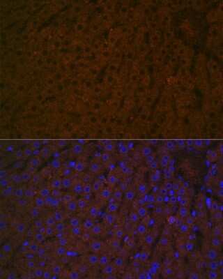 Immunohistochemistry: Haptoglobin Antibody (7C1N2) [NBP3-16700]