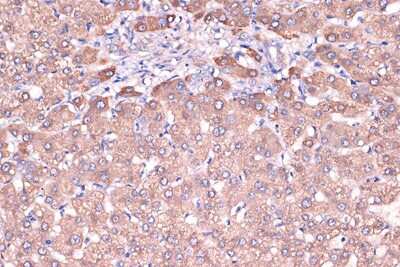 Immunohistochemistry-Paraffin: Haptoglobin Antibody (7C1N2) [NBP3-16700]