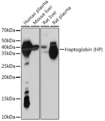 Western Blot: Haptoglobin Antibody (7C1N2) [NBP3-16700]