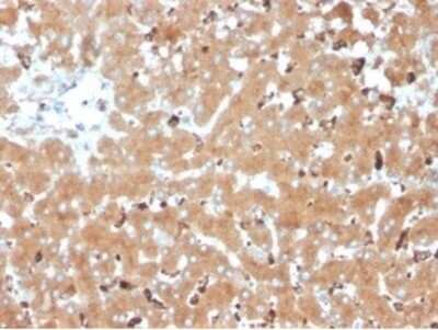 Immunohistochemistry-Paraffin: Haptoglobin Antibody (HP/3835) [NBP3-13939]