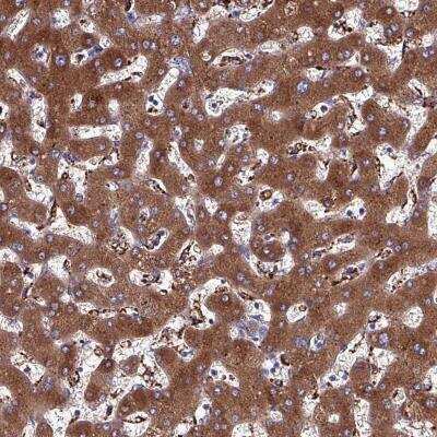 Immunohistochemistry-Paraffin: Haptoglobin Antibody [NBP2-48880]