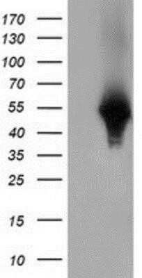 Western Blot: Haptoglobin Antibody (OTI4H5)Azide and BSA Free [NBP2-70925]