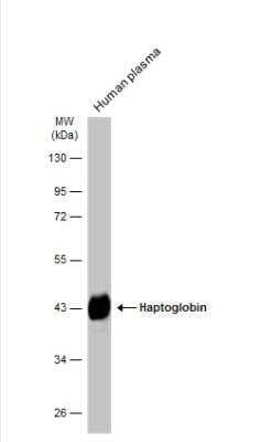 Western Blot: Haptoglobin Antibody [NBP1-32391]