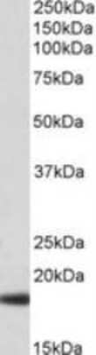 Western Blot: Haptoglobin Antibody [NBP1-97751]