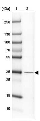 Western Blot: Haptoglobin Antibody [NBP2-48880]