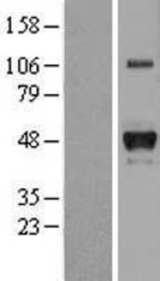 Western Blot: Haptoglobin Overexpression Lysate [NBL1-11686]