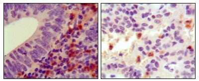 Immunohistochemistry-Paraffin: Hck Antibody (3D12E10) - BSA Free [NBP1-47514]