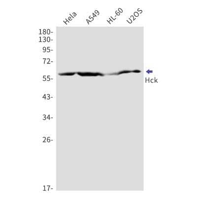 Western Blot: Hck Antibody (S02-5C1) [NBP3-14957]