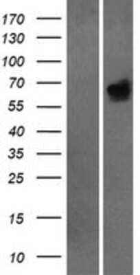 Western Blot: Hck Overexpression Lysate [NBP2-08146]