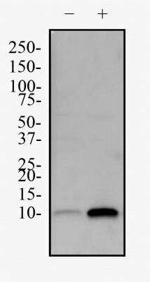 Western Blot: HeLa Chloroquine Treated / Untreated Cell Lysate [NBP2-49689]