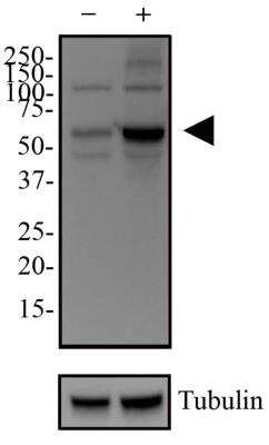 Western Blot: HeLa Chloroquine Treated / Untreated Cell Lysate [NBP2-49689]