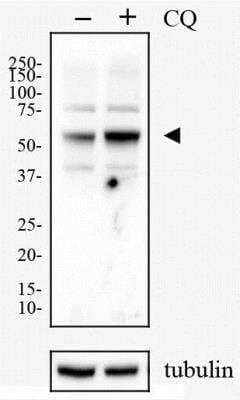 Western Blot: HeLa Chloroquine Treated / Untreated Cell Lysate [NBP2-49689]