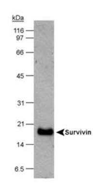 Western Blot: HeLa Whole Cell Lysate [NB800-PC1]