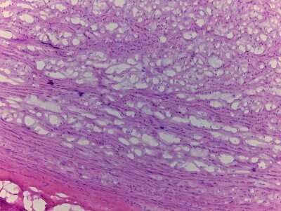 Hematoxylin & Eosin Stain: Heart Arcus Aortae Tissue Slides (Adult Normal)- Frozen [NBP2-77544]