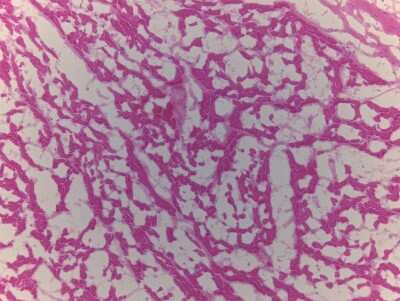 Hematoxylin & Eosin Stain: Heart Atrium Tissue Slides (Adult Normal Left)- Frozen [NBP2-77545]