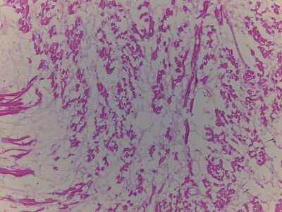Hematoxylin & Eosin Stain: Heart Atrium Tissue Slides (Adult Normal Right)- Frozen [NBP2-77546]