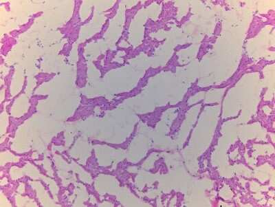 Hematoxylin & Eosin Stain: Heart Auricula Tissue Slides (Adult Normal Left)- Frozen [NBP2-77547]