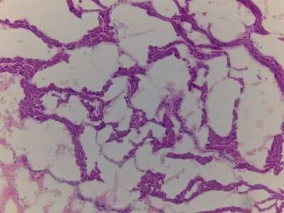 Hematoxylin & Eosin Stain: Heart Auricula Tissue Slides (Adult Normal Right)- Frozen [NBP2-77548]