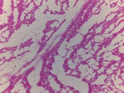 Hematoxylin & Eosin Stain: Heart Interventricular Septum Tissue Slides (Adult Normal)- Frozen [NBP2-77549]