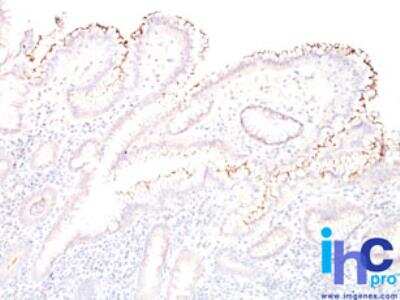 Immunohistochemistry-Paraffin: Helicobacter Pylori Antibody [NBP2-29479]
