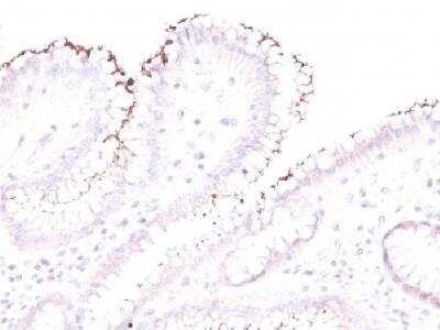 Immunohistochemistry-Paraffin: Helicobacter Pylori Antibody [NBP2-29479]