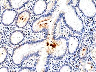 Immunohistochemistry-Paraffin: Helicobacter Pylori Antibody (RM400) [NBP2-89094]