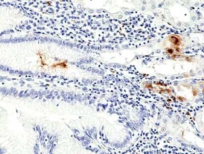 Immunohistochemistry-Paraffin: Helicobacter Pylori Antibody (RM429) [NBP3-09179]