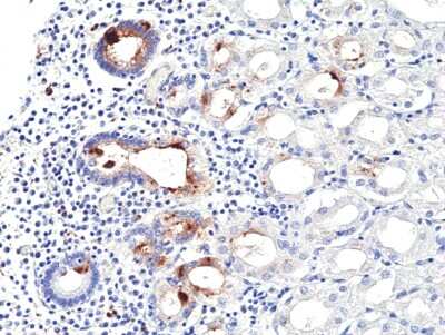 Immunohistochemistry-Paraffin: Helicobacter Pylori Antibody (RM429) [NBP3-09179]