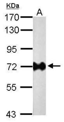 Western Blot: Helicobacter pylori urease B Antibody (1263) [NBP2-42853]