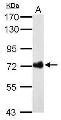 Western Blot: Helicobacter pylori urease B Antibody (962) [NBP2-42852]