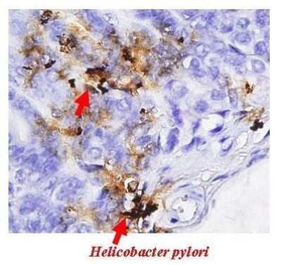 Immunohistochemistry-Paraffin: Helicobacter pylori urease B Antibody [NBP2-42850]