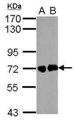 Western Blot: Helicobacter pylori urease B Antibody [NBP2-42850]