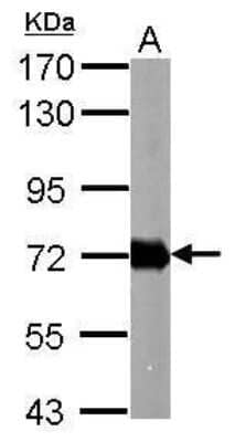 Western Blot: Helicobacter pylori urease B Antibody [NBP2-42851]