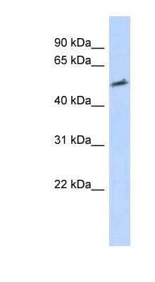 Western Blot: Helios Antibody [NBP1-79703]