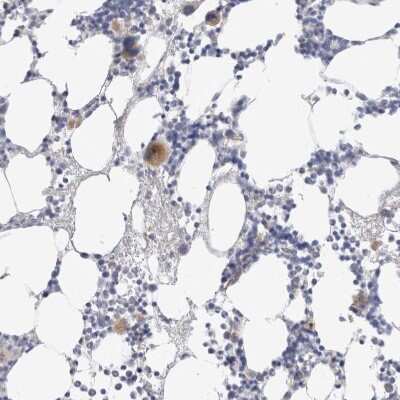 Immunohistochemistry-Paraffin: Hematopoietic Prostaglandin D Synthase/HPGDS Antibody [NBP1-83322]