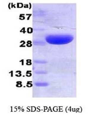 SDS-PAGE: Recombinant Human HO-1/HMOX1/HSP32 His Protein [NBC1-22928]