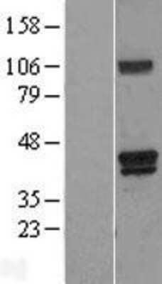 Western Blot: HO-2/HMOX2 Overexpression Lysate [NBL1-11625]