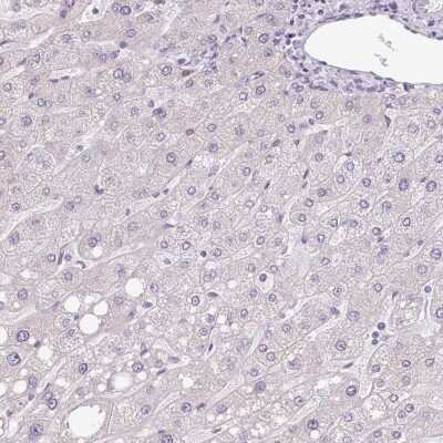 Immunohistochemistry-Paraffin: Hemicentin 2 Antibody [NBP2-30512]