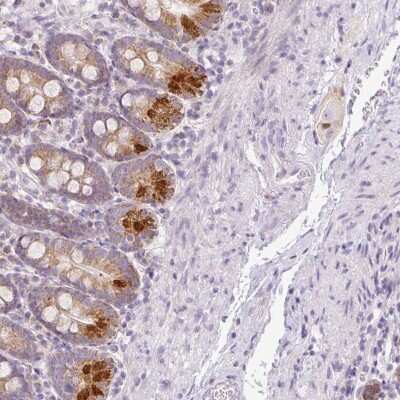 Immunohistochemistry-Paraffin: Hemicentin 2 Antibody [NBP2-30512]