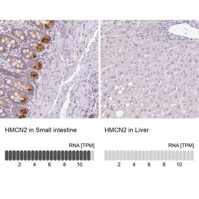 Immunohistochemistry-Paraffin: Hemicentin 2 Antibody [NBP2-30512]