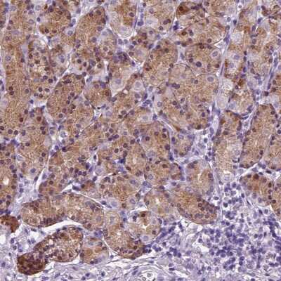 Immunohistochemistry-Paraffin: Hemicentin 2 Antibody [NBP2-57366]