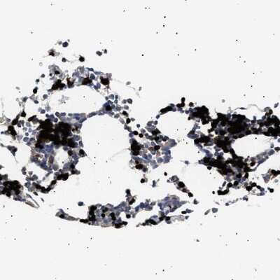 Immunohistochemistry-Paraffin: Hemogen Antibody [NBP1-84907]