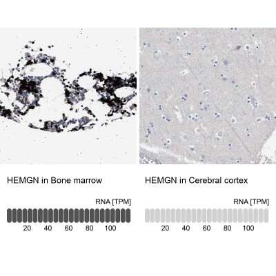 Immunohistochemistry-Paraffin: Hemogen Antibody [NBP1-84907]