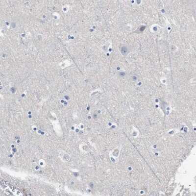 Immunohistochemistry-Paraffin: Hemogen Antibody [NBP1-84907]