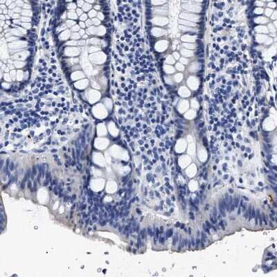 Immunohistochemistry-Paraffin: Hemogen Antibody [NBP1-84907]