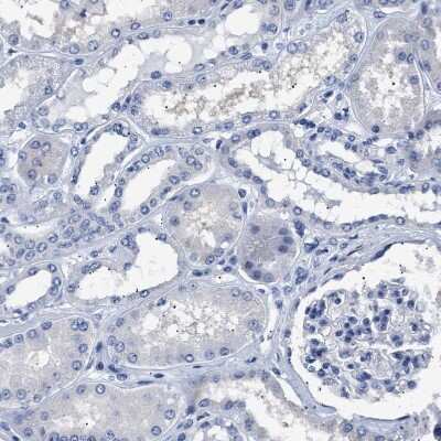 Immunohistochemistry-Paraffin: Hemogen Antibody [NBP1-84907]