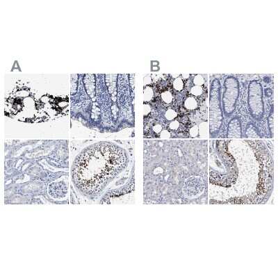 Immunohistochemistry-Paraffin: Hemogen Antibody [NBP1-84907]