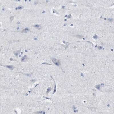 Immunohistochemistry-Paraffin: Hemogen Antibody [NBP1-84908]